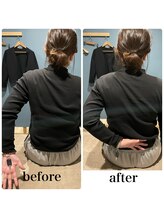 フィジオリハ 久屋大通店/筋膜リリース