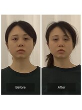 美容整体プラスフィール 横浜店/美容整体/エステ/リラク