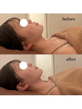 オアシス カナヤマ(Oasis kanayama)/【フェイシャル】