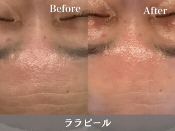 トウメイコガオ 横浜店/トウメイコガオ【ララピール】