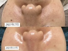 グラン ジュテの雰囲気（ララピール・プラピール・エクソソーム月1回継続的ケアで肌管理）