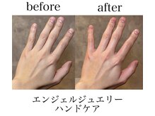 メルディアナ(MAR DIANA)の雰囲気（あなたの抱える頑固な手の悩みも一撃で解決！）