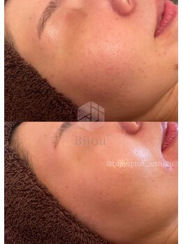 ビジュープラス ひたち野うしく店(Bijou+)/