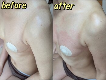 スノードロップ(snowdrop)/