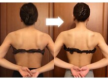 ヴァン ベール 那覇店/肩甲骨だし引き締めケア