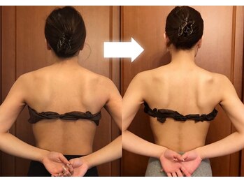 ヴァン ベール 那覇店/肩甲骨だし引き締めケア
