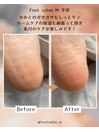 【足裏角質ケア】女性