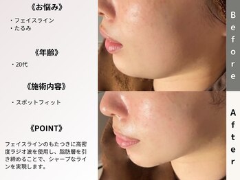 ルディラ 上野店/スポットフィット