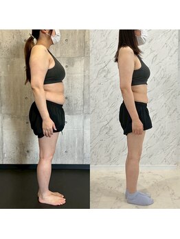 ルビア 岡崎矢作店(LUVIA)/Before&After