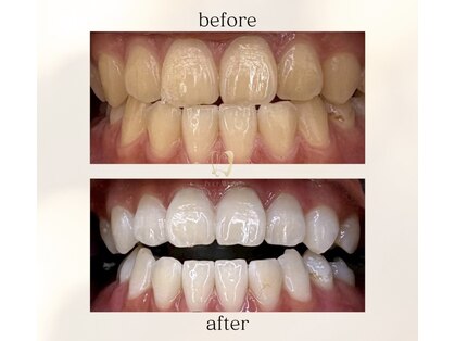 ルセホワイト 室蘭登別(LUCE WHITE)の写真