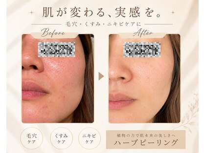 ワイズビューティ(Y’s Beauty)の写真