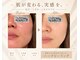 ワイズビューティ(Y’s Beauty)の写真
