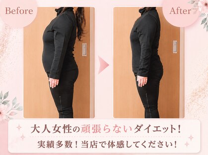 ヨサパーク ビリュウ(YOSA PARK Bellyu)の写真