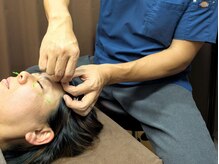 のなか鍼灸院/美容鍼