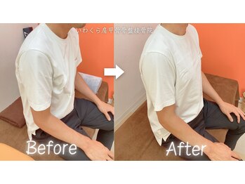 いわくら肩甲骨 骨盤接骨院BTG 一宮千秋/猫背矯正・肩甲骨はがし 1