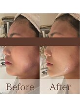 凪眠/小顔リンパフェイシャルの効果38