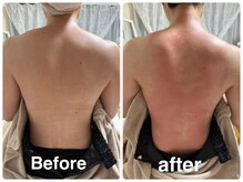 メロー(MELLOW)/トーンヌール