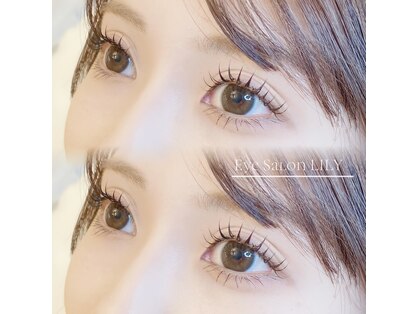 リリー(LILY)の写真