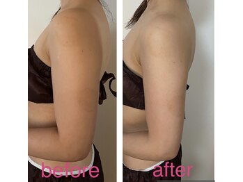 オードリリー(eau de Lily)/体験エステでもこの変化