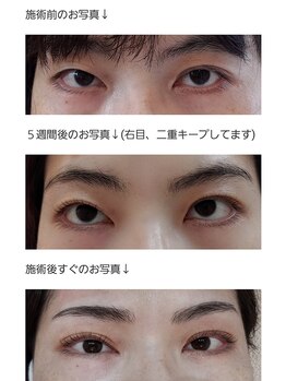 アロマスイーツ(AromaSweets)/まつげパーマ/まつ毛パーマ