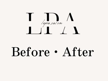 レピア JR和歌山駅前店/韓国式LEPIA Before&Aｆter