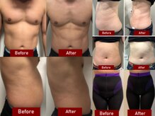 イロミエ 四日市店(iromie.)の雰囲気(完全プライベートサロンが四日市市にOPEN!#脱毛#痩身#リンパ)