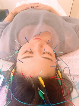 瑞 鍼灸院/頭皮鍼+美容鍼