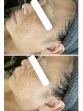 エヌ(enu)/フェイシャル