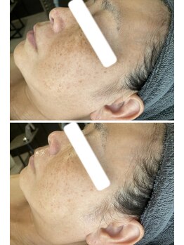 エヌ(enu)/フェイシャル