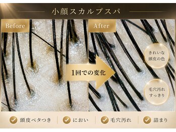 ポノ 甲府本店(pono)/小顔スカルプスパ