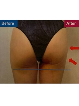 イデアル 箱崎(ideal)/