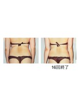アルファイン 諏訪店/腰まわりがスッキリ！