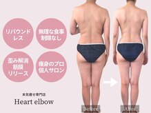 ハートエルボー(Heart elbow)