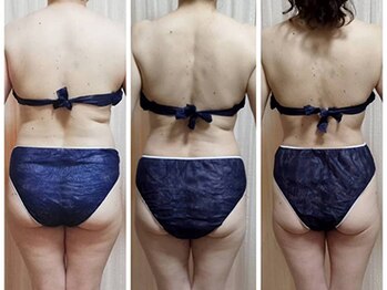 ヨサパーク リュミエール 三鷹(YOSA PARK Lumiere)/ビフォーアフター3