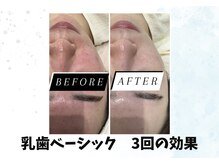 リンフェイス 浦安店(RINFACE)の雰囲気（なによりも継続が大切★肌質改善はRIN FACEにお任せください♪）