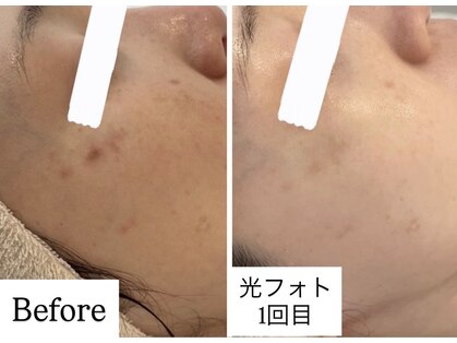 クロア ナゴヤ(Croire NAGOYA)の写真