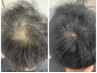 韓国発CURAIM育毛促進ケア 初回半額