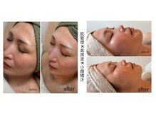 ビオン 松戸(bion)の雰囲気（頭皮から筋膜をゆるめ、高周波と肌管理で土台から整える小顔ケア）