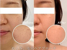 ビビラフィネ(BiBi Raffine)の雰囲気(頬のもたつき、毛穴開きが気にならなくなりました。透明感もUP!)