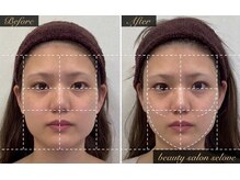 「小顔に本気。」都度払い小顔専門店beauty salon seloveの雰囲気（劇的変化を！小顔で目元の印象もUP♪）