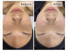 ホーミー(Homie)/くすみ改善◎