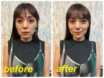 テテドベベヘッドスパバイアンレーヴ(tete de bebe headspa by unreve)/ヘッドスパ before→after