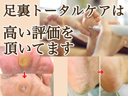 巻き爪補正店 湘南辻堂店の写真