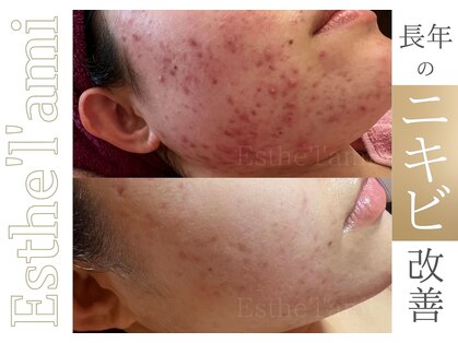 エステ ラミ(Esthe' l'ami)の写真