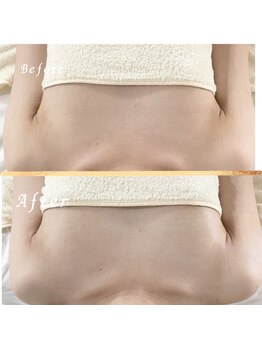 タワワ(TaWaWa)/40代女性　ボリュームでお悩み