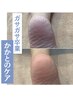 《歩くたびに痛むガサガサかかとは卒業！》かかとケラチンピール　