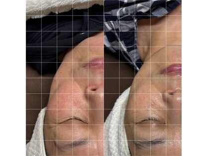 ミヨン(Miyong)の写真