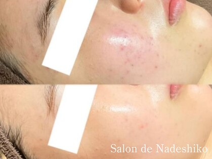 サロン ド ナデシコ(Salon de Nadeshiko)の写真