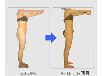 ネオボディ(Neo Body)/回数重ねてる事に変化が♪