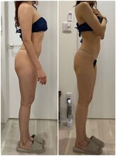 プラチナアース つくば店(Platinum earth)/痩身ビフォーアフター